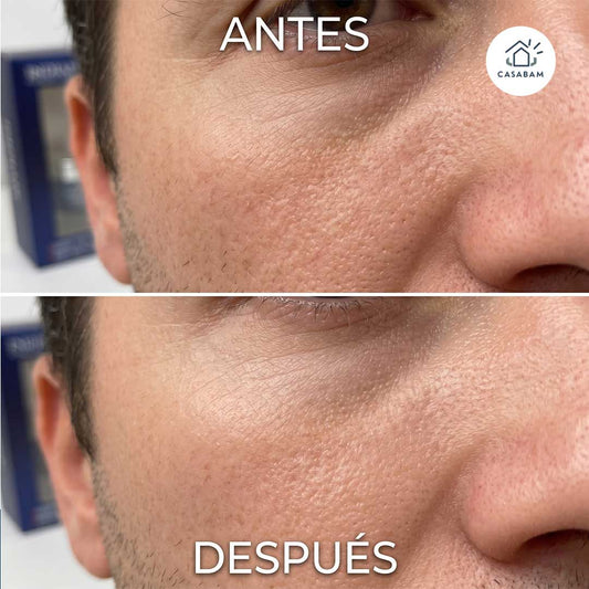 Pack Renovación Facial para Hombre - Hidrata y regenera la piel masculina desde adentro, reduciendo arrugas y resequedad día a día.