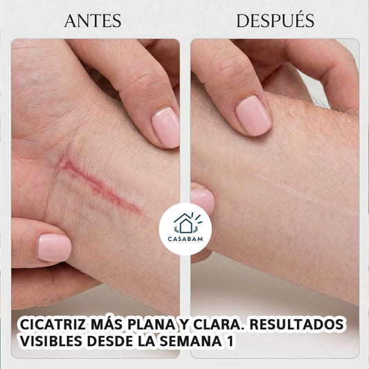 Parche de silicona para cicatrices - Reduce cicatrices queloides sin cremas ni procedimientos invasivos