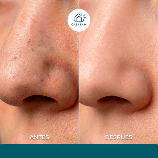 Mascarilla de Carbón en barra - Purificación Facial - Remueve impurezas y devuelve un aspecto saludable a tu piel