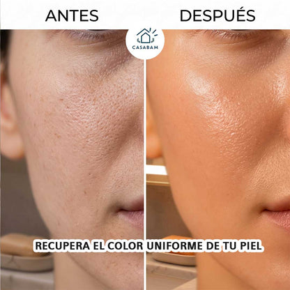 Jabón de cúrcuma - Aclara manchas oscuras con uso diario - Recupera el color natural de tu piel