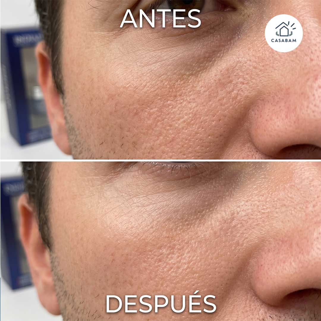 Pack Renovación Facial para Hombre - Hidrata y regenera la piel masculina desde adentro, reduciendo arrugas y resequedad día a día.