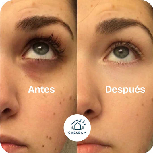 Parches de colagenos autodisolvent - Elimina ojeras y reduce bolsas mientras se disuelve solo en solo 20 minutos. en tu piel