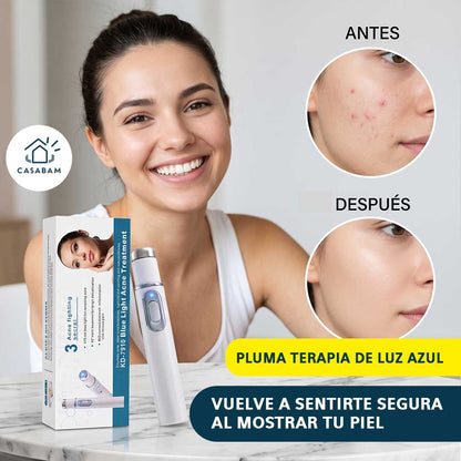 Pluma terapia de luz azul - Trata imperfecciones de la piel al instante - Rostro liso y libre de manchas, sin salir de casa