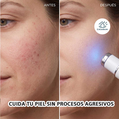Pluma terapia de luz azul - Trata imperfecciones de la piel al instante - Rostro liso y libre de manchas, sin salir de casa