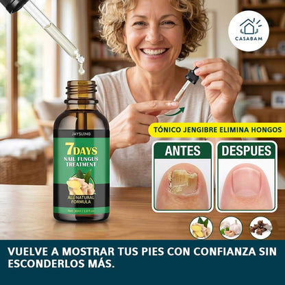Tónico Jengibre Elimina hongos - Recupera uñas bonitas y saludables - y vuelve a mostrar tus pies con confianza.