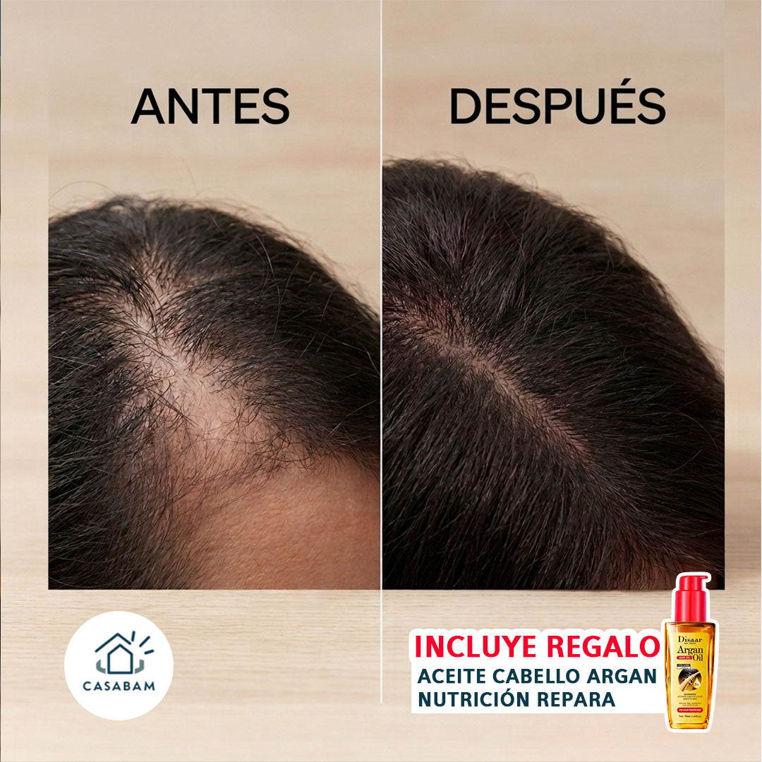 Pack tratamiento capilar: Cepillo y Aceite – Activa el crecimiento capilar desde casa sin tratamientos costosos