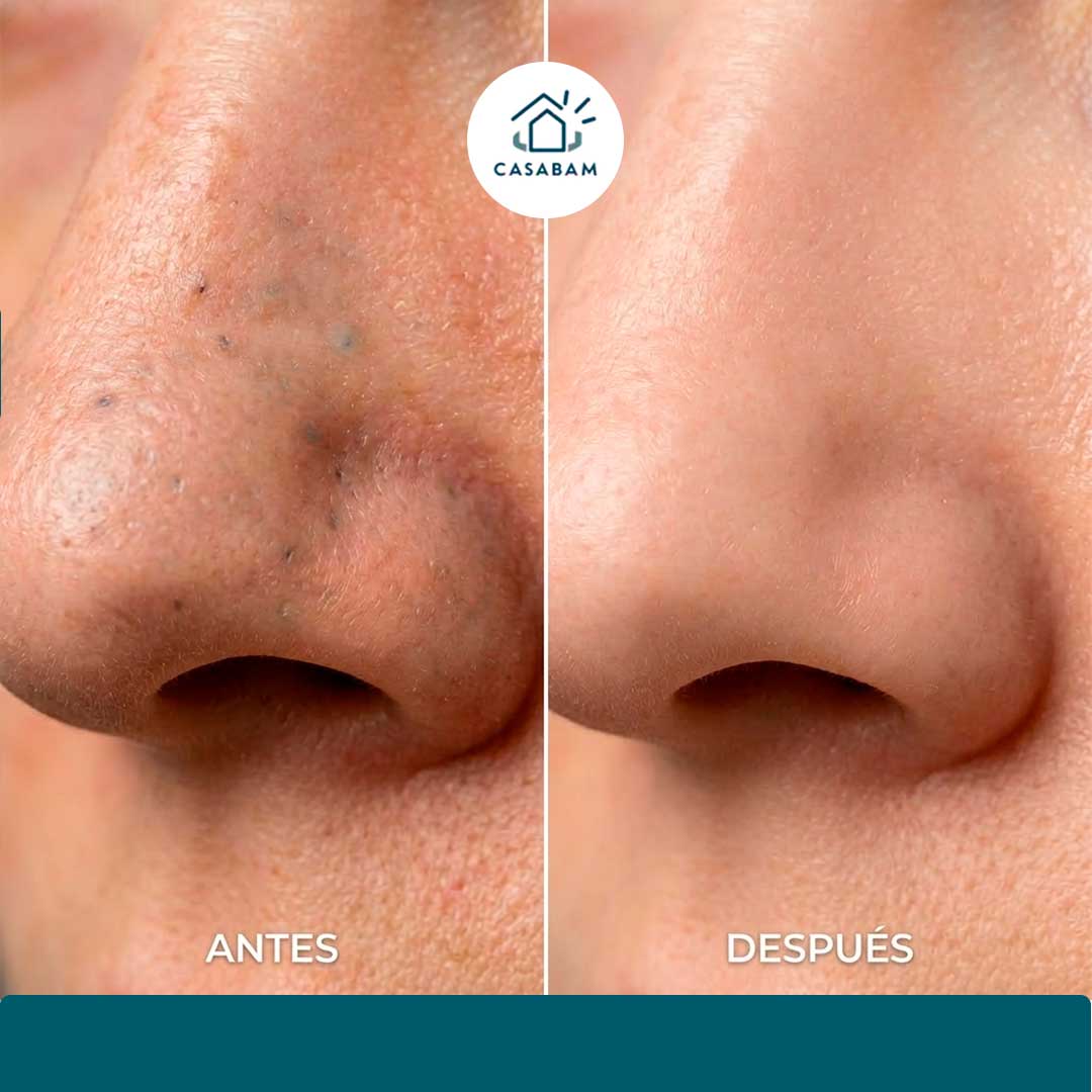 Mascarilla de Carbón en barra - Purificación Facial - Remueve impurezas y devuelve un aspecto saludable a tu piel