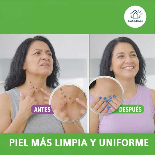 Tag Off Tratamiento Anti Carnosidades - Acción Localizada - Mejora la apariencia de tu piel sin marcas visibles